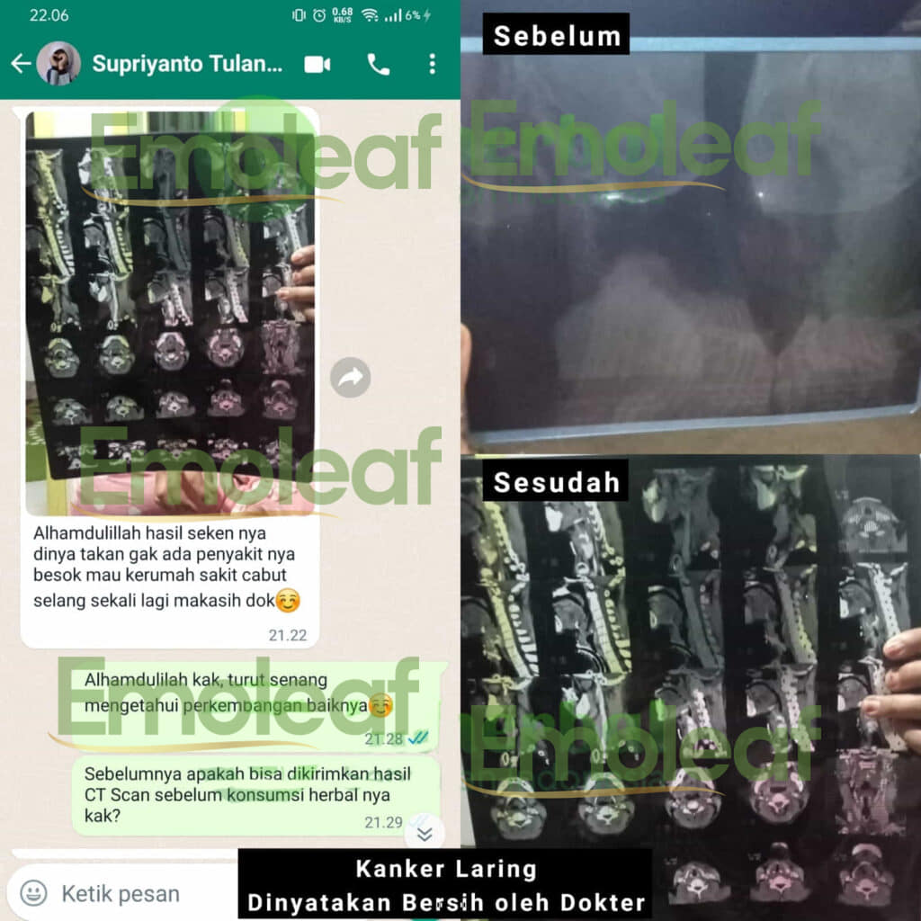 Testi WA Supriyanto